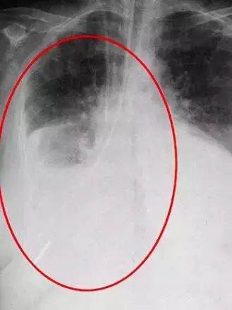 太恐怖！澳洲大妈挣扎2小时，最终惨死在医院！真相令人发指，这是在杀人啊...