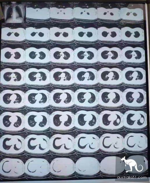 武汉疫区日记:和妻儿生死别离的 28 天