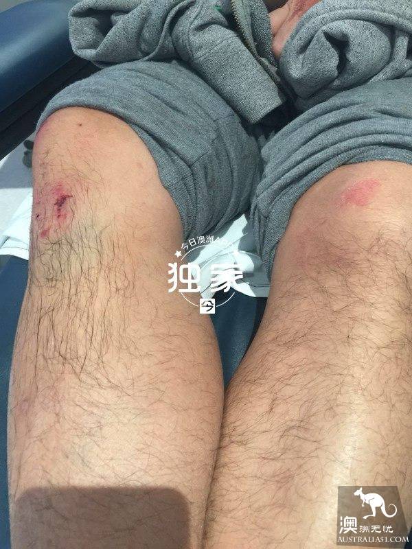 “他们叫嚣捅死我们、强奸我,还想烧店!”卧龙岗华人及留学生成袭击目标,频遭殴抢,多人受伤!