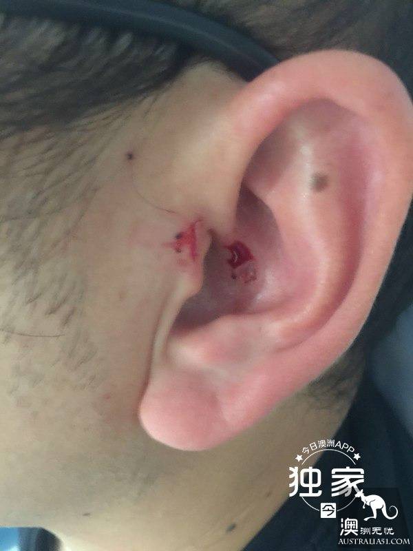 “他们叫嚣捅死我们、强奸我,还想烧店!”卧龙岗华人及留学生成袭击目标,频遭殴抢,多人受伤!