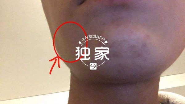 “他们叫嚣捅死我们、强奸我,还想烧店!”卧龙岗华人及留学生成袭击目标,频遭殴抢,多人受伤!